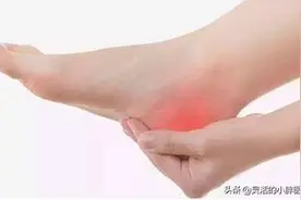 后脚跟疼！是痛风吗？和高跟鞋有关系吗？还是长骨刺了呢？图片