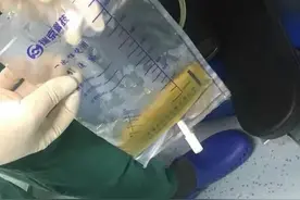 护士必看：胸腔闭式引流护理，这些细节不容小觑图片