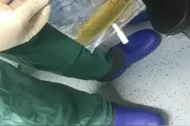 护士必看：胸腔闭式引流护理，这些细节不容小觑图片
