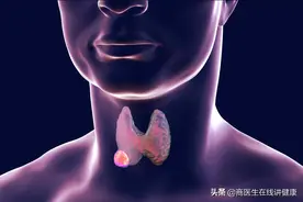 优甲乐的副作用：是否会增加骨质疏松，导致骨折的发生风险？图片