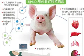 为移植猪的器官，进行的“人猪杂交”实验，可以带来生的希望吗？图片