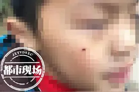 南昌：击剑课上孩子脸被“划花”，负责人：想退费有点难图片