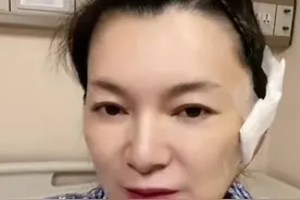 54岁"金花婆婆"就医！做全麻手术切囊肿，有气无力还要赶工作图片
