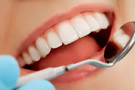 牙齿矫正后如何保持口腔卫生习惯？要注意这几点图片