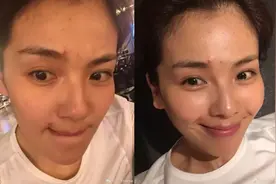为什么女明星长痘好得快，你长痘就好的慢？区别在这里图片