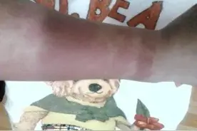 用就烂脸？护肤品里的酒精到底有多可怕？图片