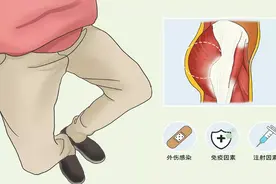 丨康复馆丨您有蹲不下去的时候吗？图片