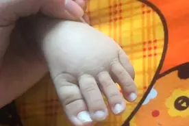 宝宝脚趾赛手指，妈妈伸出脚大家又沸腾了，网友：长大得长多高？图片