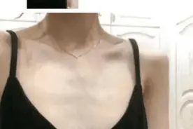 “女友出差回来, 说脖子上拔了火罐”网友评论有点东西图片