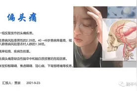 偏头痛病因与发病机制详解「记得收藏分享」图片