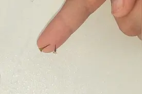 手指头扎刺怎么剔除？别再用针挑，教你一正确去刺不留痕小妙招，图片