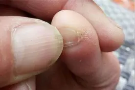小脚趾的指甲长成两瓣，真的是纯种汉族人的标志吗？图片