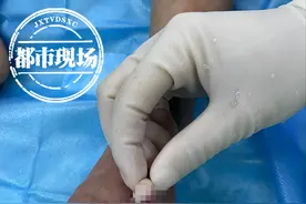 痛得心揪着！南昌3岁男童“搬石头砸了自己脚”，2根脚趾砸断图片