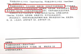 真实案例：是药三分毒？不吃药甲亢真的能自己好吗？图片