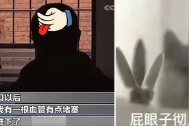 割包皮能割到头皮上去？？？这什么阴间医院？图片