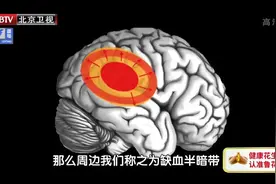 脑梗有个“黄金救命时间”，错过可能就晚了！有这个症状赶紧就医图片
