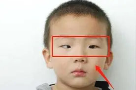 5岁孩子总是做这件事，导致黑眼球“消失”，家长不要忽略细节图片