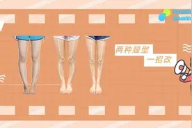 「o型腿」的两种类型，你知道吗？图片