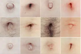 肚脐眼里面到底有多脏？图片