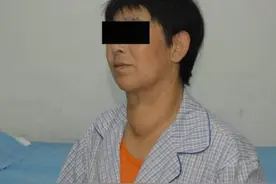 别只盯着“大脖子”！医生：有这4种症状，也说明甲亢来了图片