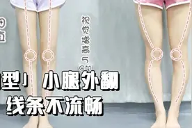 练腿攻略：3个简单动作，消除顽固型小腿外翻图片