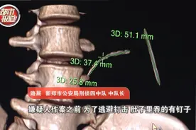 女子生吞铁钉？！背后引出伸向大学生的黑手...都市报道独家关注图片