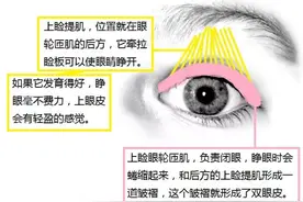 南华博士：双眼皮手术有哪些，它们的区别在哪里？图片