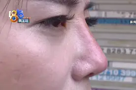 养生馆里隆鼻变红鼻子后续：鼻子还是红，“冤家”成“姐妹”？图片