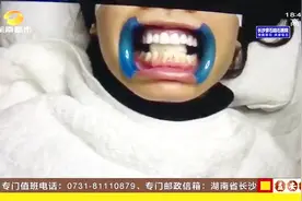 神秘的美牙项目！美牙如同染指甲，无名涂料称“商业机密”