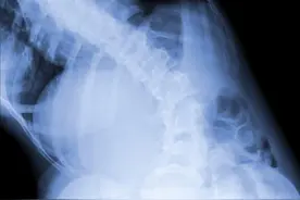 整个人看起来上身是歪的，要当心你的骨盆了图片
