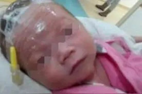 3个月孩子吃了母乳后脸色通红，送去医院检查后，医生连连叹气图片
