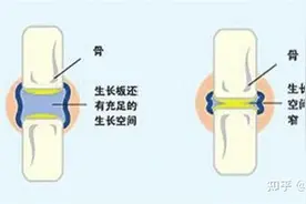 每天坚持摸高对长高有帮助吗？图片