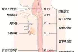 食管出现这种改变，当心癌变图片