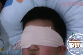 风火轮突然炸裂，男孩捂着眼睛痛哭大叫，医生：眼球破裂图片