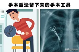 在人体内所发现的5个非常奇怪的事物图片