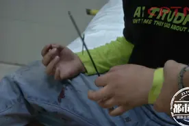 看着都疼！8岁男孩玩射箭游戏，手指直接被30厘米残箭贯穿图片