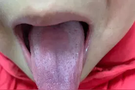 艾灸这件事，咱们是不是别随便做了图片