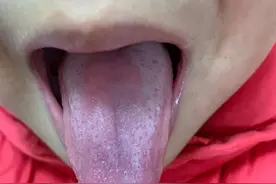 艾灸这件事，咱们是不是别随便做了图片