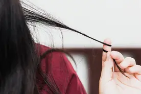 爱揪自己的毛发是有病吗？图片