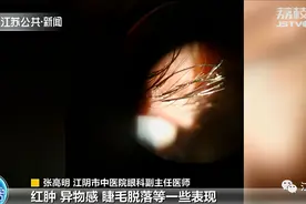 可怕又恶心！女子种完假睫毛真睫毛也保不住了：上边爬着密密麻麻的“蠕虫”图片
