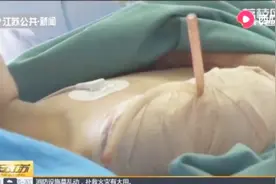关注暑期儿童安全!8岁男孩家中玩耍被玻璃割断大动脉,鲜血直流！视频封面