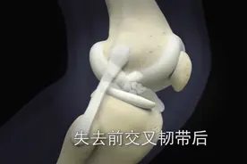 医瑞康复科普：动画演示前叉韧带的位置、作用和断裂后的重建术视频封面