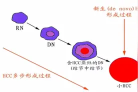 普美显MR增强如何鉴别肝脏良恶性病变视频封面