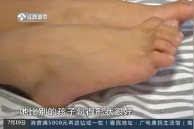 女童长了双“马蹄”脚，家人以为是舞蹈天赋，一查竟是这个病视频封面