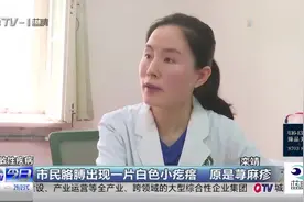 市民胳膊出现一片白色小疙瘩 原是荨麻疹 医生教你远离过敏！视频封面