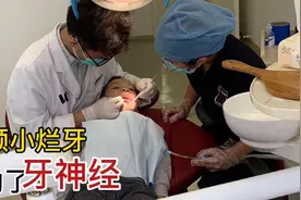 孩子烂牙致牙神经需切断再治疗，别纠结补牙问题，预防比治疗重要视频封面