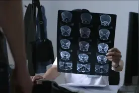 近视眼的朋友注意了，隐形眼镜带反结果很严重视频封面