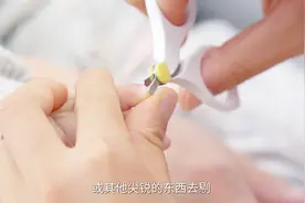 宝宝指甲长得快，总抓破自己的脸，该怎么安全地给宝宝剪指甲？视频封面