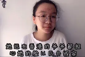 青春期脸上长满痘痘 一碰就流血 个个红肿又化脓 都要毁容了视频封面