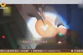 你不了解的医生！锋利的手术刀，他给生鸡蛋“做手术”！视频封面